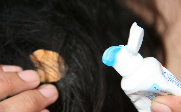 How To Remove Bubble Gum From Hair